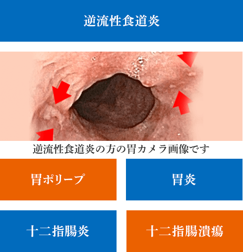 京都 胃カメラ 鎮静剤 鼻からの楽な胃カメラは金光診療所へ